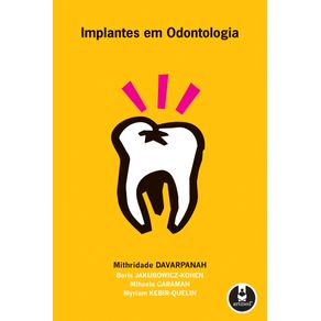 Implantes-em-Odontologia