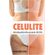 Celulite--hidrolipodistrofia-ginoide---HLDG--e-Estrias-