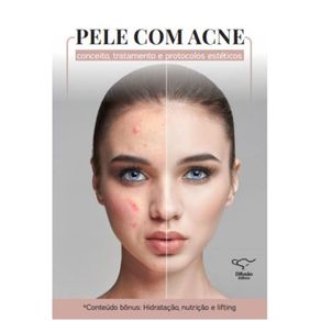 Pele-com-acne--conceito-tratamento-e-protocolos-esteticos---Conceito-tratamento-e-protocolos-esteticos