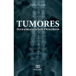 Tumores-Intrarraquianos-Primarios
