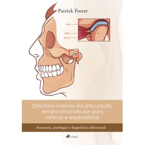 Disturbios-internos-da-articulacao-temporomandibular-para-clinicos-e-especialistas--Anatomia-patologia-e-diagnostico-diferencial