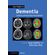 Case-Studies-in-Dementia