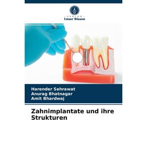 Zahnimplantate-und-ihre-Strukturen