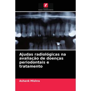 Ajudas-radiologicas-na-avaliacao-de-doencas-periodontais-e-tratamento