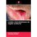 Lesoes-vesicobolhosas-da-regiao-orofacial