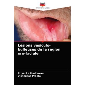 Lesions-vesiculo-bulleuses-de-la-region-oro-faciale