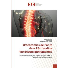 Osteotomies-de-Ponte-dans-lArthrodese-Posterieure-Instrumentee