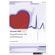 Impulsformen-der-Defibrillation