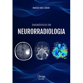 Diagnosticos-em-neurorradiologia