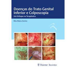 Doencas-do-Trato-Genital-Inferior-e-Colposcopia:-Um-Enfoque-na-Terapeutica