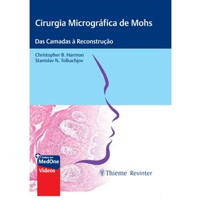 Cirurgia-Micrografica-de-Mohs:-Das-Camadas-a-Reconstrucao