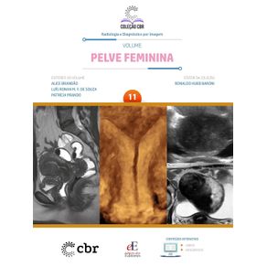 Colecao-CBR-Volume-11-PELVE-FEMININA