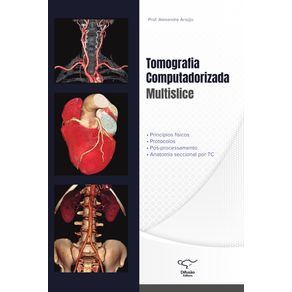 Tomografia-Computadorizada-Multislice