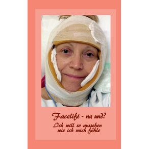 Facelift---na-und-
